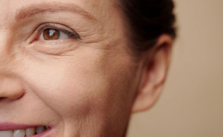 Tratamentos topicos para rugas dinamicas 021af9ef