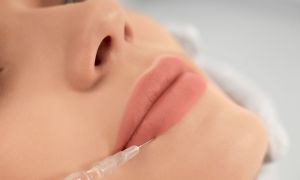 odontologia estetica