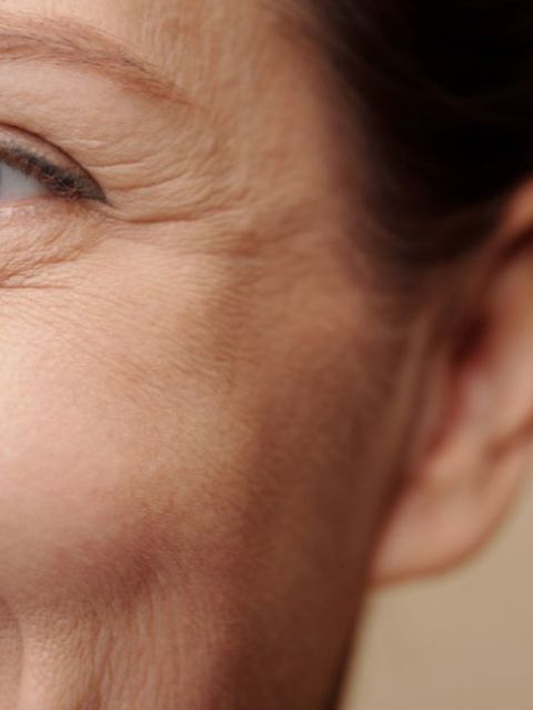 Tratamentos topicos para rugas dinamicas 279fcf76