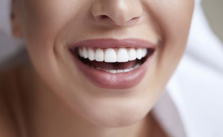 Alimentos que escurecem os dentes 34e00820