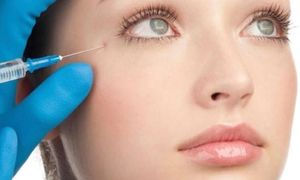 Harmonização- orofacial- estética