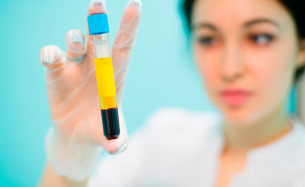 Utilização do PRF na Harmonização Facial