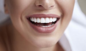 Alimentos que escurecem os dentes 418cd43e