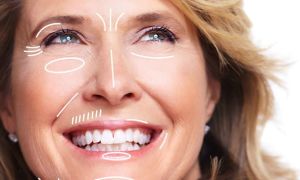 O que o dentista pode fazer na estética?