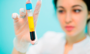 Utilização do PRF na Harmonização Facial