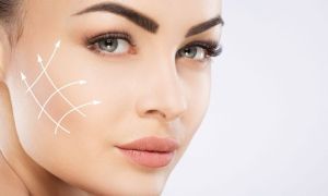 harmonização-facial