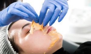 Mídia e CFM se aproveitam de polêmicas envolvendo peeling de fenol a fim de descredibilizar estetas