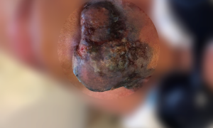 necrose editado3 867a0c4b