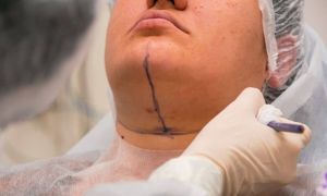 Design sem nome 11 882fa834