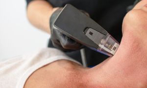 Morpheus o novo queridinho da estetica e uma oportunidade lucrativa 8e38afaa