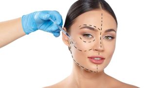 harmonização facial indicações