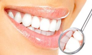 Facetas-Estéticas-lentes-de-contato-para-dentes