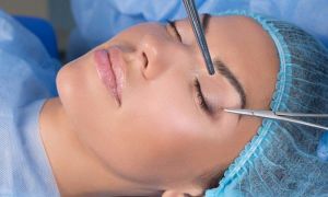 2019 07 blefaroplastia sem cortes e possivel 1 802x506 1 b8051a76