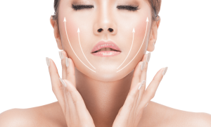 Harmonização Orofacial vai além do sorriso perfeito 7 bichectomia