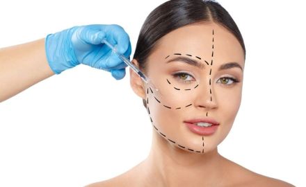 harmonização facial indicações