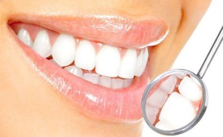 Facetas-Estéticas-lentes-de-contato-para-dentes