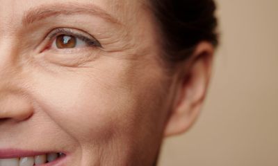 Barbie botox - o procedimento deve ser indicado ou evitado? 11 Tratamentos topicos para rugas dinamicas fa0f9e74