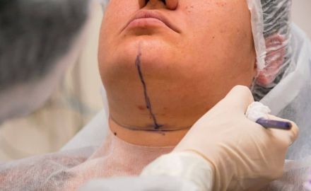 Design sem nome 11 fd43742a