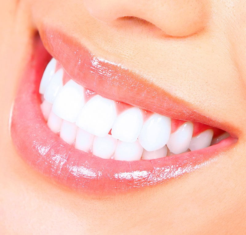 Clareamento-dental- estética-dentes
