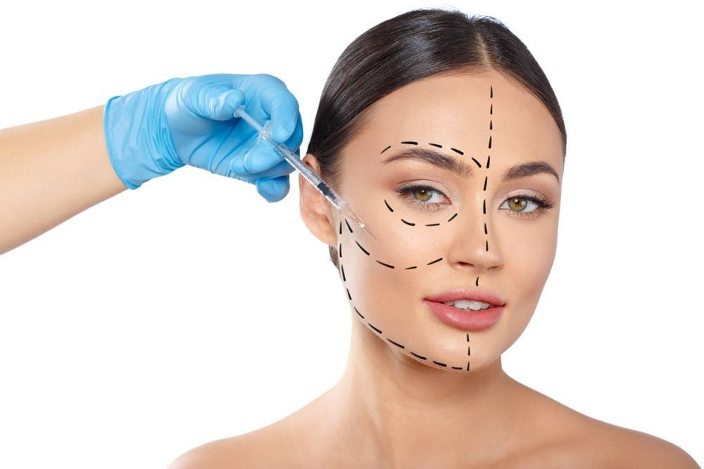 harmonização facial indicações