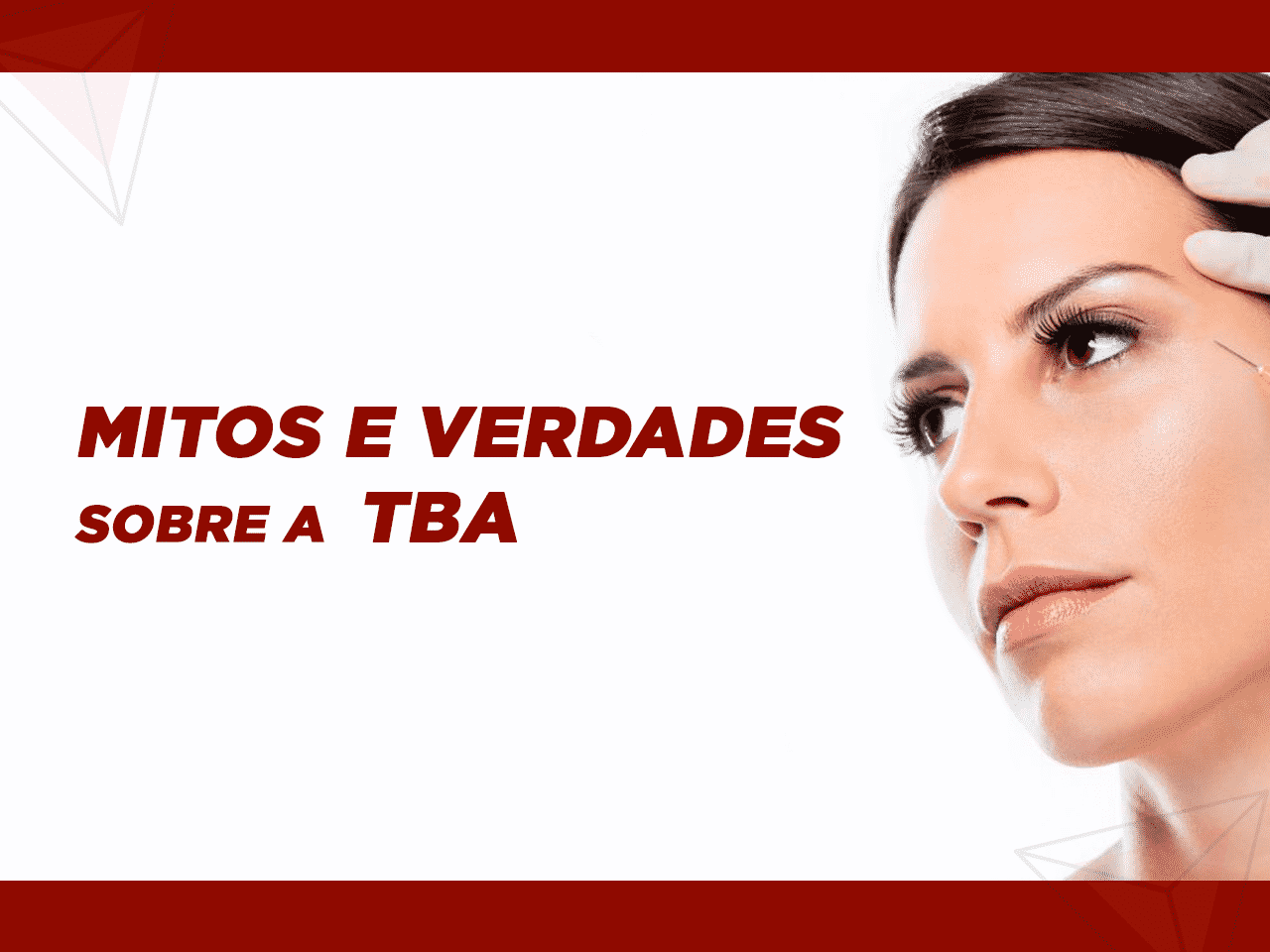 Procedimentos com Toxina Botulínica - mitos e verdades
